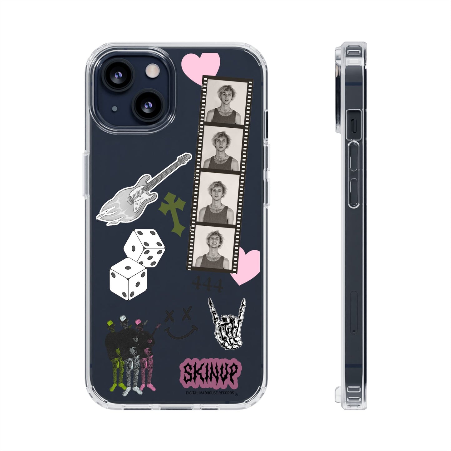 $kin Up Sticker Phone Case
