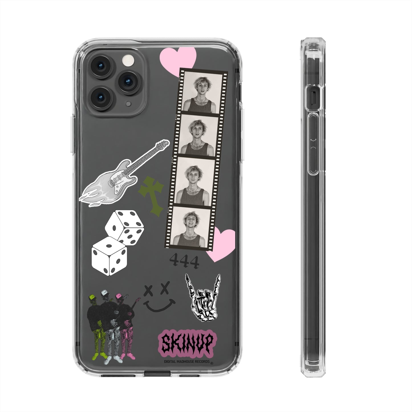 $kin Up Sticker Phone Case